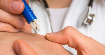 Natural Ways to Reduce Lyme Disease Risk