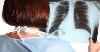 Tips to Prevent Lung Cancer